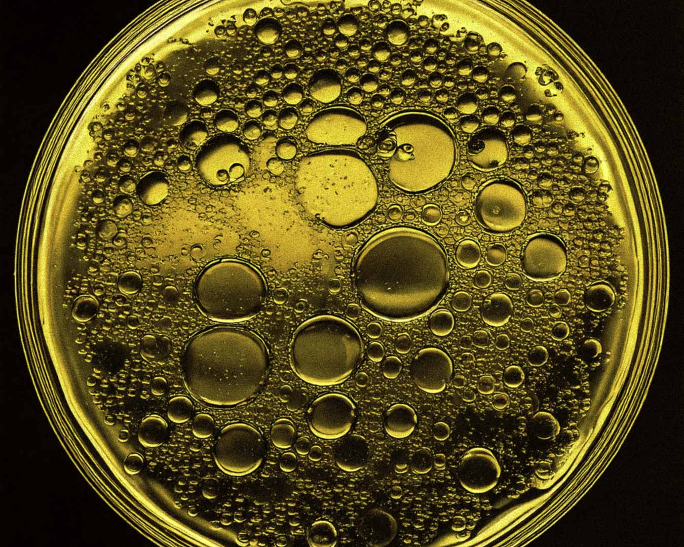 Olive Oil Unsaponifiables